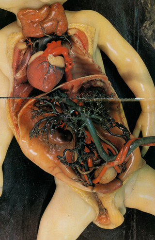 Illustration for article titled Wax anatomical figures are the stuff of nightmares